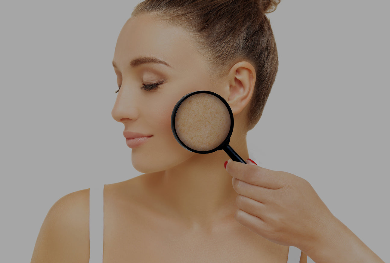 Dark Spots On Skin