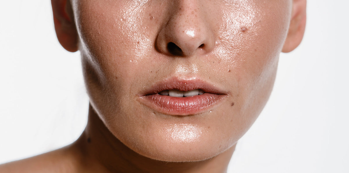 Why Is My Face So Oily? The Science Behind the Shine (and How to Fix I